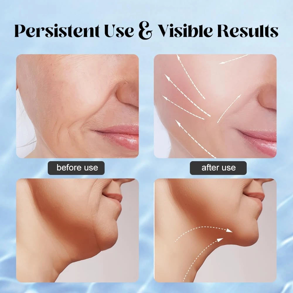 Masajeador Facial de Cuello, Dispositivo para Estirar la Piel, LED Antiarrugas, Doble Mentón EE. UU.